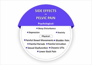 pelvic-pain-treatment-in-pune