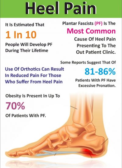Your Guide to Plantar Fasciitis and Heel Spurs